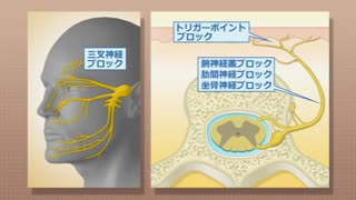 【全巻セット】知っておきたい痛みの知識DVD全2巻