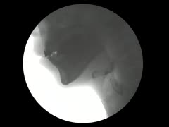 【全巻セット】看護のための病態生理とアセスメントDVD全14巻