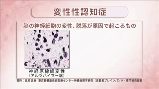 【全巻セット】認知症高齢者の看護 パーソン・センタード・ケアの視点DVD全6巻