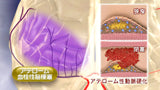 【全巻セット】リハビリテーション医学 第2版DVD全20巻