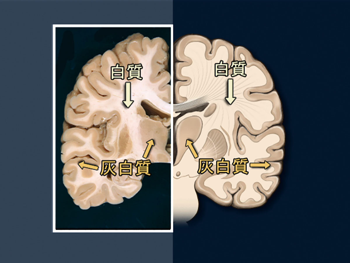 【全巻セット】目で見る解剖と生理 第2版DVD全15巻