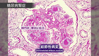 目で見る病気 第3版 [Vol.13] 腎・泌尿器・生殖器系の疾患