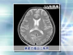 医療チームに必要な 画像医学の知識と技術 [Vol.03] MRI検査