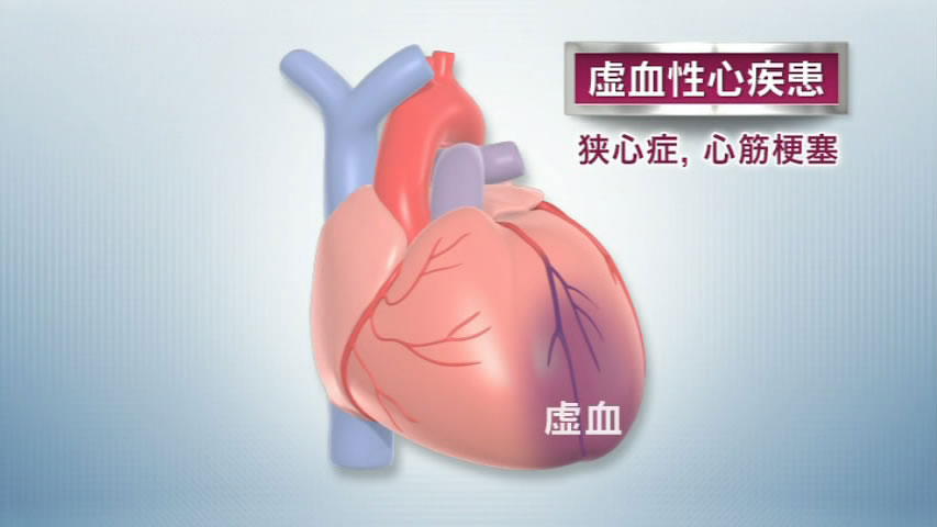 リハビリテーション医学 第2版 [Vol.15] 心臓のリハビリテーション