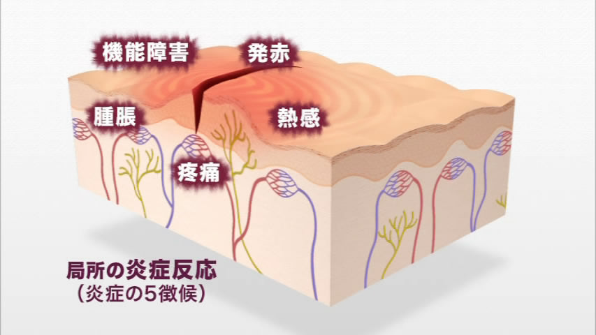 目で見る薬理学入門 第3版 [Vol.07] 炎症と免疫性疾患の治療薬