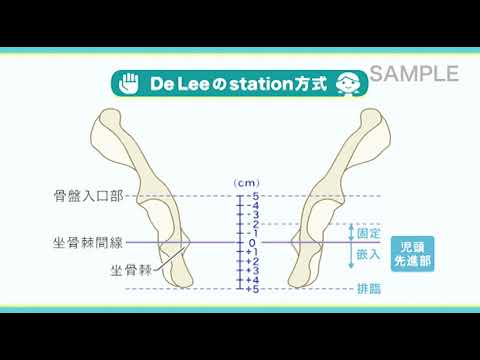 目で見る母性看護 第2版 [Vol.04] 分娩経過のアセスメントと看護 入院時の健康診査 – 医学映像教育センター 公式オンラインショップ