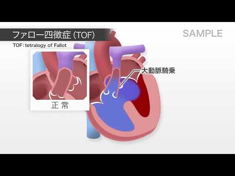 目で見る病気 第3版 [Vol.08] 循環器系の疾患 – 医学映像教育センター